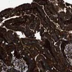 Immunohistochemistry (Formalin/PFA-fixed paraffin-embedded sections) - Anti-SNX30 antibody (AB121600)