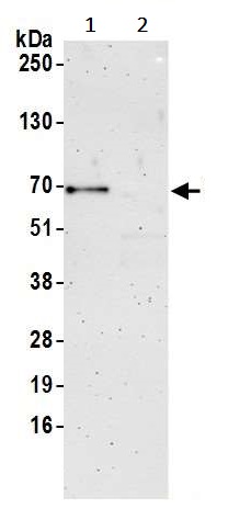 Immunoprecipitation - Anti-SNX33 antibody (AB241201), expandable thumbnail