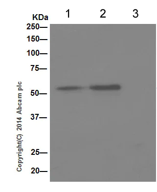 Immunoprecipitation - Anti-SNX4 antibody [EPR16954] - C-terminal (AB198504)