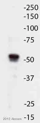 Western blot - Anti-SNX5 antibody (AB5983)