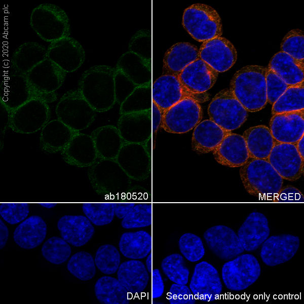 Immunocytochemistry/ Immunofluorescence - Anti-SNX5 antibody [EPR14358] (ab180520), expandable thumbnail