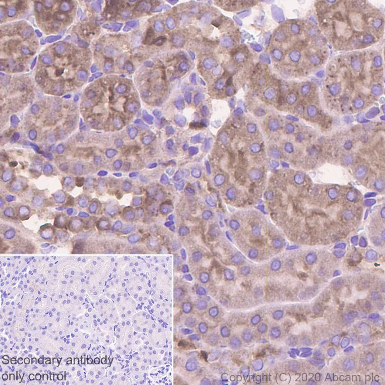 Immunohistochemistry (Formalin/PFA-fixed paraffin-embedded sections) - Anti-SNX5 antibody [EPR14358] (AB180520)
