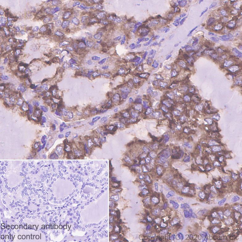 Immunohistochemistry (Formalin/PFA-fixed paraffin-embedded sections) - Anti-SNX5 antibody [EPR14358] (AB180520), expandable thumbnail