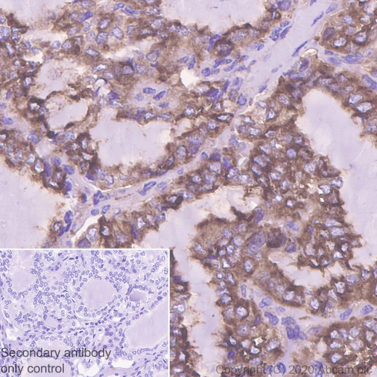 Immunohistochemistry (Formalin/PFA-fixed paraffin-embedded sections) - Anti-SNX5 antibody [EPR14358] (AB180520)