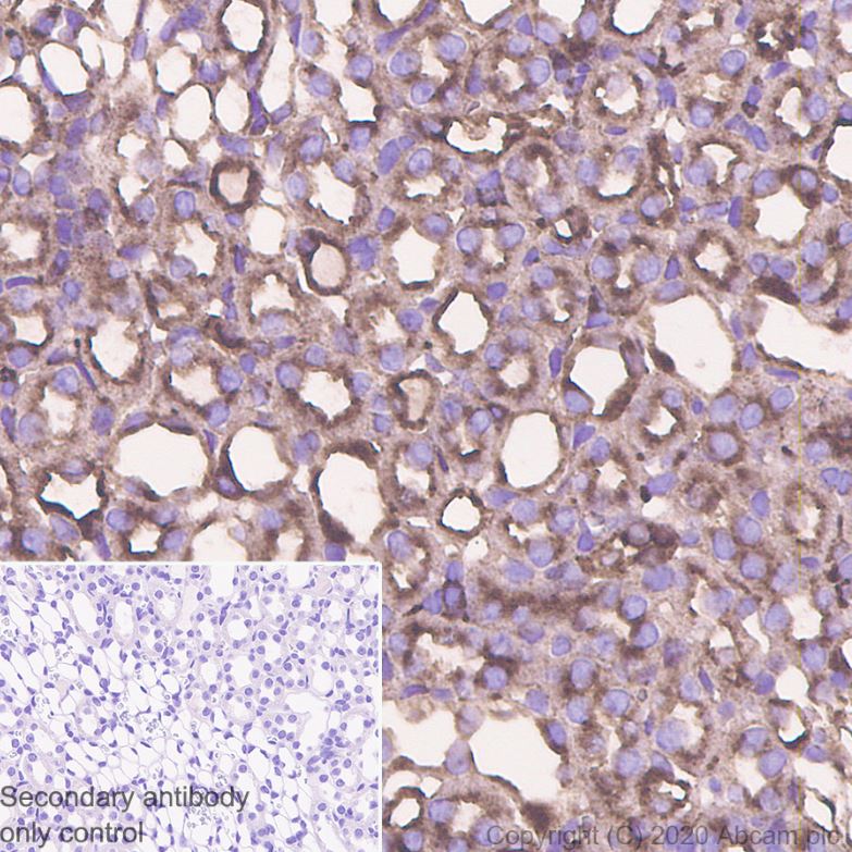 Immunohistochemistry (Formalin/PFA-fixed paraffin-embedded sections) - Anti-SNX5 antibody [EPR14358] (AB180520), expandable thumbnail