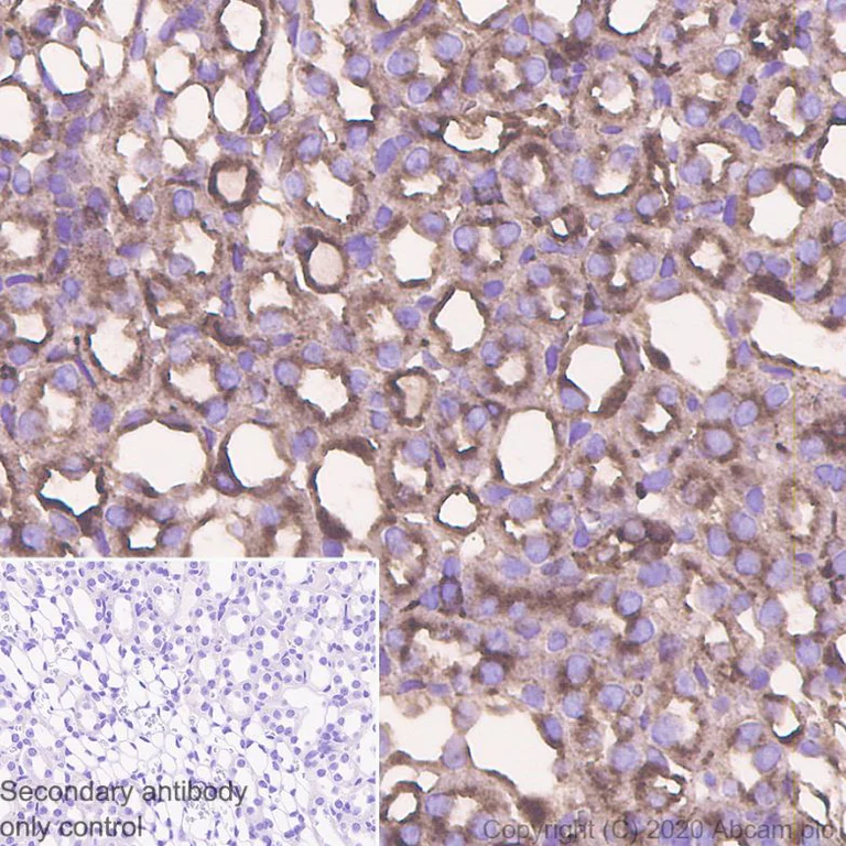 Immunohistochemistry (Formalin/PFA-fixed paraffin-embedded sections) - Anti-SNX5 antibody [EPR14358] (AB180520)