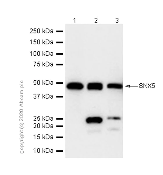 Western blot - Anti-SNX5 antibody [EPR14358] (AB180520)