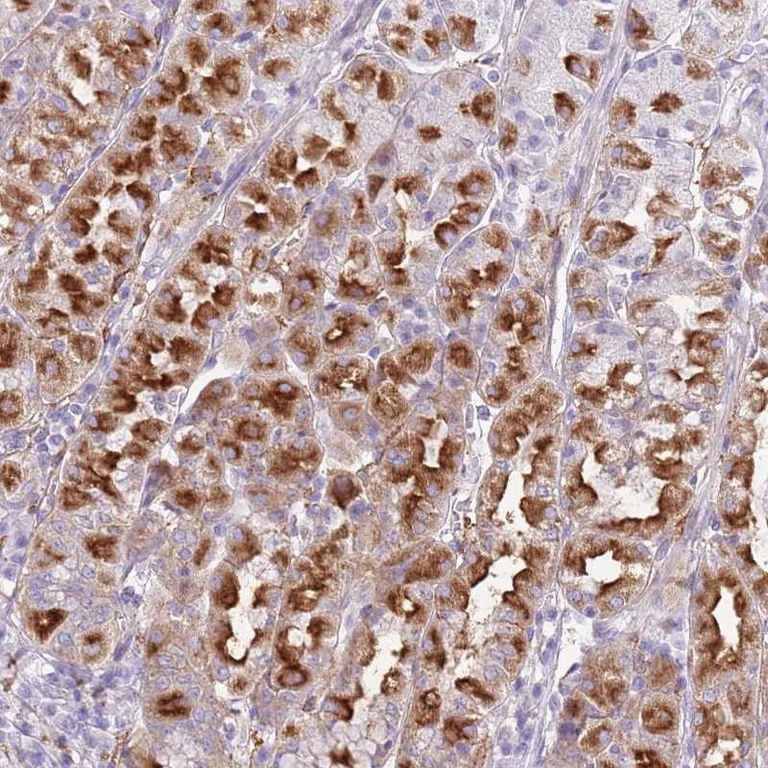 Immunohistochemistry (Formalin/PFA-fixed paraffin-embedded sections) - Anti-Snx6 antibody (AB247087)