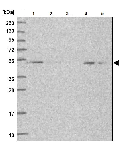 Western blot - Anti-Snx6 antibody (AB247087)