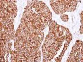 Immunohistochemistry (Formalin/PFA-fixed paraffin-embedded sections) - Anti-SNX7 antibody (AB126954)