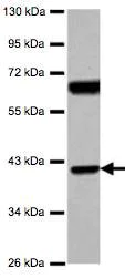 Western blot - Anti-SNX7 antibody (AB126954)