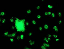 Immunocytochemistry/ Immunofluorescence - Anti-SNX8 antibody [OTI3C4] (AB119388), expandable thumbnail