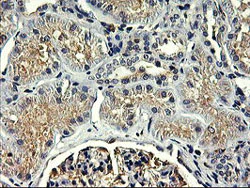 Immunohistochemistry (Formalin/PFA-fixed paraffin-embedded sections) - Anti-SNX8 antibody [OTI3C4] (AB119388)