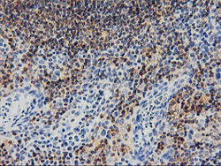 Immunohistochemistry (Formalin/PFA-fixed paraffin-embedded sections) - Anti-SNX8 antibody [OTI3C4] (ab119388), expandable thumbnail