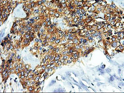 Immunohistochemistry (Formalin/PFA-fixed paraffin-embedded sections) - Anti-SNX8 antibody [OTI3C4] (AB119388), expandable thumbnail