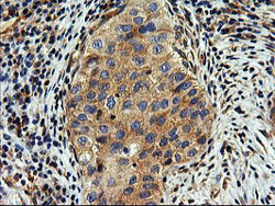 Immunohistochemistry (Formalin/PFA-fixed paraffin-embedded sections) - Anti-SNX8 antibody [OTI3C4] (ab119388), expandable thumbnail