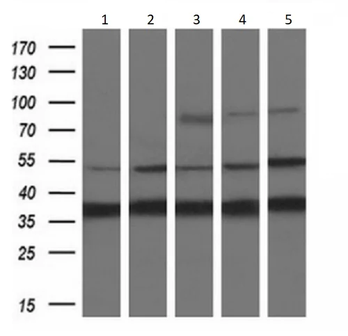 Western blot - Anti-SNX8 antibody [OTI3C4] (AB119388)