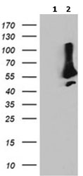 Western blot - Anti-SNX8 antibody [OTI3C4] (ab119388), expandable thumbnail