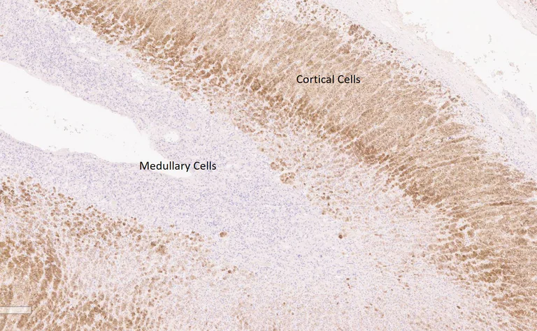 Immunohistochemistry (Formalin/PFA-fixed paraffin-embedded sections) - Anti-SOAT 1/ACAT1 antibody (AB39327)