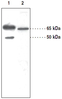 Western blot - Anti-SOAT 1/ACAT1 antibody (AB39327)