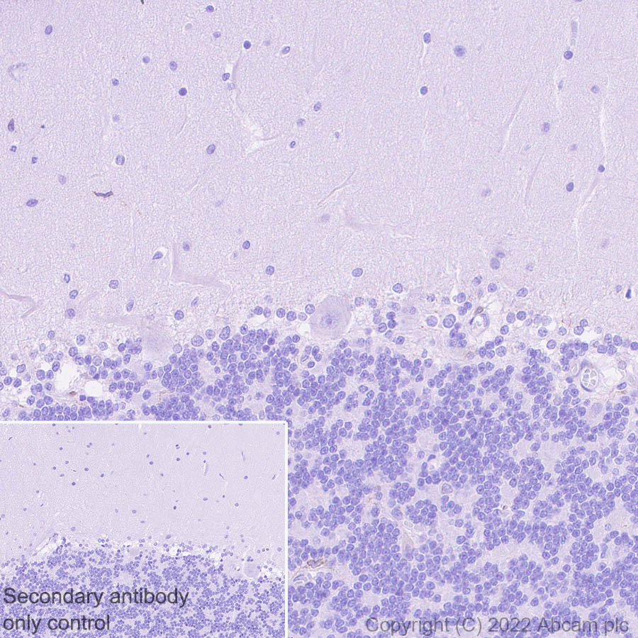 Immunohistochemistry (Formalin/PFA-fixed paraffin-embedded sections) - Anti-SOAT 1/ACAT1 antibody [EPR26952-40] (AB307597)
