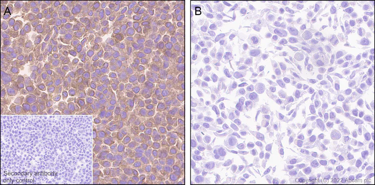 Immunohistochemistry (Formalin/PFA-fixed paraffin-embedded sections) - Anti-SOAT 1/ACAT1 antibody [EPR26952-40] (AB307597)