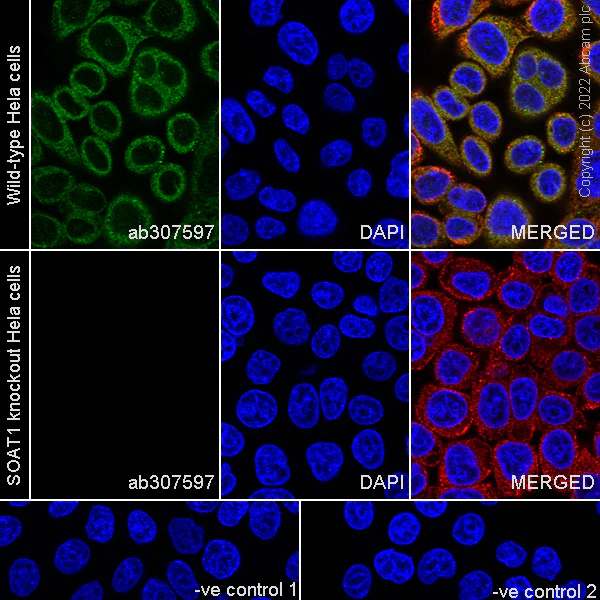 Immunocytochemistry/ Immunofluorescence - Anti-SOAT 1/ACAT1 antibody [EPR26952-40] - BSA and Azide free (AB307598)
