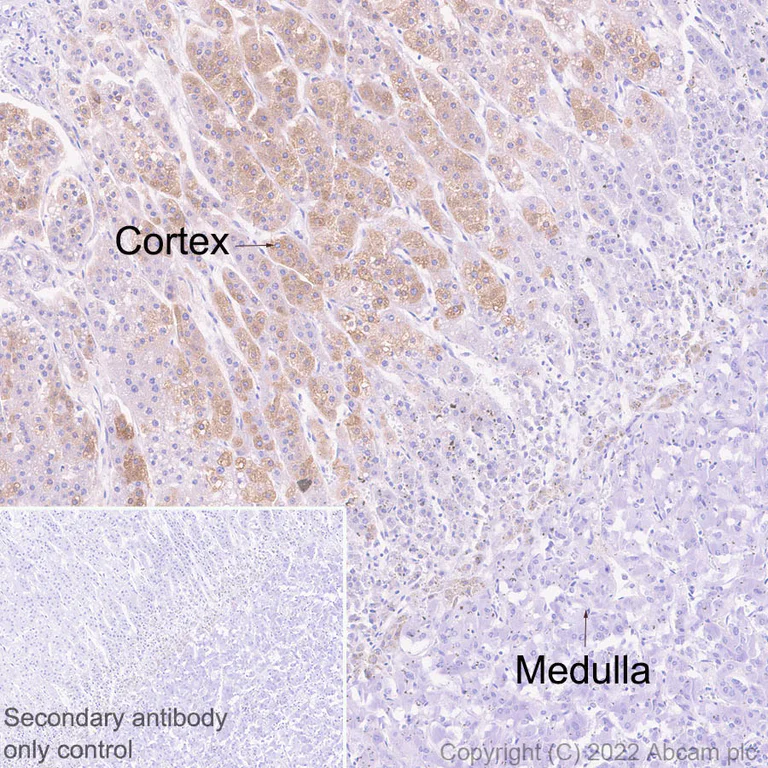 Immunohistochemistry (Formalin/PFA-fixed paraffin-embedded sections) - Anti-SOAT 1/ACAT1 antibody [EPR26952-40] - BSA and Azide free (AB307598)