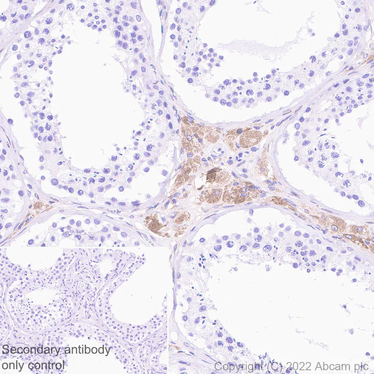 Immunohistochemistry (Formalin/PFA-fixed paraffin-embedded sections) - Anti-SOAT 1/ACAT1 antibody [EPR26952-40] - BSA and Azide free (AB307598)