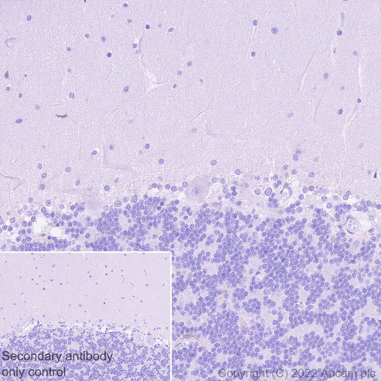 Immunohistochemistry (Formalin/PFA-fixed paraffin-embedded sections) - Anti-SOAT 1/ACAT1 antibody [EPR26952-40] - BSA and Azide free (AB307598)