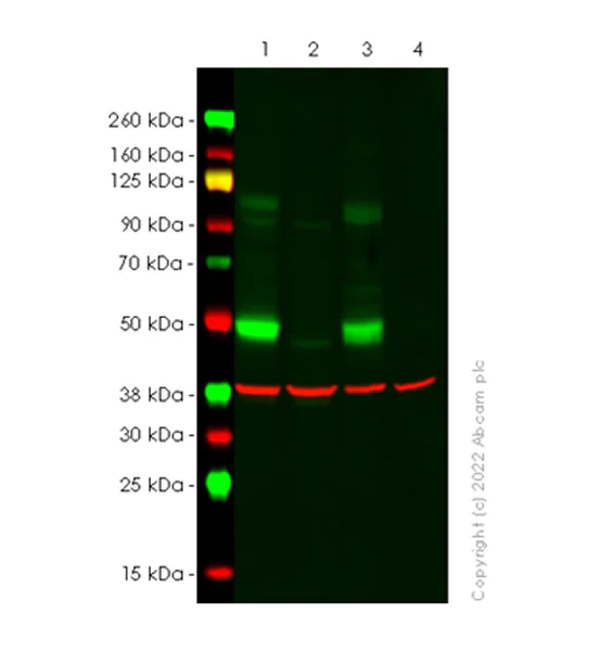 Western blot - Anti-SOAT 1/ACAT1 antibody [EPR26952-40] - BSA and Azide free (AB307598)