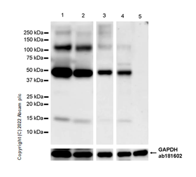 Western blot - Anti-SOAT 1/ACAT1 antibody [EPR26952-40] - BSA and Azide free (AB307598)
