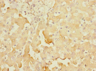 Immunohistochemistry (Formalin/PFA-fixed paraffin-embedded sections) - Anti-SOAT 2 antibody (AB230210), expandable thumbnail