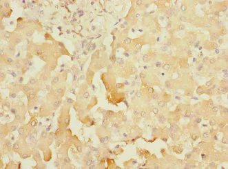 Immunohistochemistry (Formalin/PFA-fixed paraffin-embedded sections) - Anti-SOAT 2 antibody (AB230210)