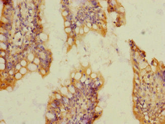 Immunohistochemistry (Formalin/PFA-fixed paraffin-embedded sections) - Anti-SOAT 2 antibody (AB230210), expandable thumbnail