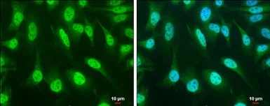 Immunocytochemistry/ Immunofluorescence - Anti-SOCS1 antibody (AB137384)