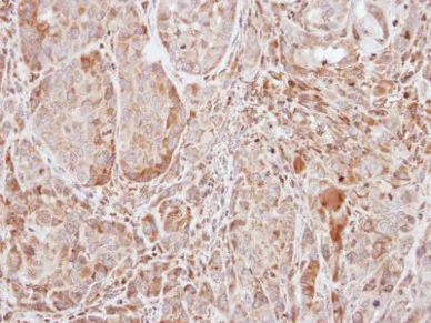 Immunohistochemistry (Formalin/PFA-fixed paraffin-embedded sections) - Anti-SOCS1 antibody (AB137384)