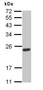 Western blot - Anti-SOCS1 antibody (AB137384)