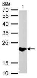 Western blot - Anti-SOCS1 antibody (AB137384)