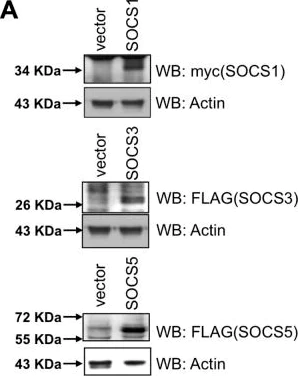 Western blot - Anti-SOCS1 antibody (AB62584)