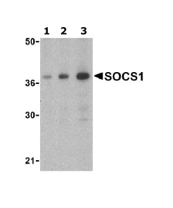Western blot - Anti-SOCS1 antibody (AB62584)