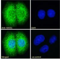 Immunocytochemistry - Anti-SOCS1 antibody (AB9870)