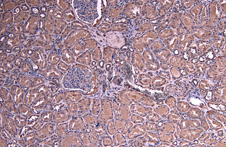 Immunohistochemistry (Formalin/PFA-fixed paraffin-embedded sections) - Anti-SOCS1 antibody (AB9870)
