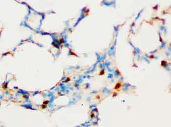 Immunohistochemistry (Formalin/PFA-fixed paraffin-embedded sections) - Anti-SOCS1 antibody - Carboxyterminal end (AB65989)