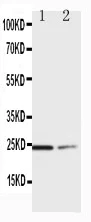 Western blot - Anti-SOCS1 antibody - Carboxyterminal end (AB65989)