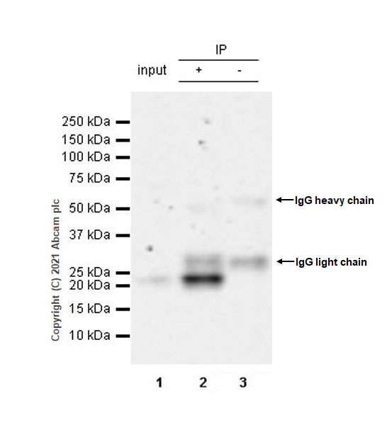 Immunoprecipitation - Anti-SOCS1 antibody [EPR24290-356] (AB280886), expandable thumbnail