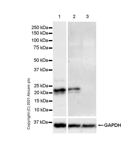 Western blot - Anti-SOCS1 antibody [EPR24290-356] (AB280886), expandable thumbnail