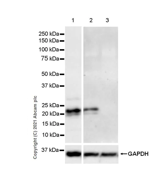 Western blot - Anti-SOCS1 antibody [EPR24290-356] (AB280886)