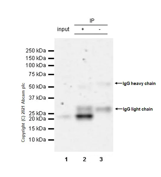 Immunoprecipitation - Anti-SOCS1 antibody [EPR24290-356] - BSA and Azide free (AB280895)