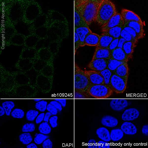 Immunocytochemistry/ Immunofluorescence - Anti-SOCS2 antibody [EPR2588(2)] - BSA and Azide free (AB247806), expandable thumbnail